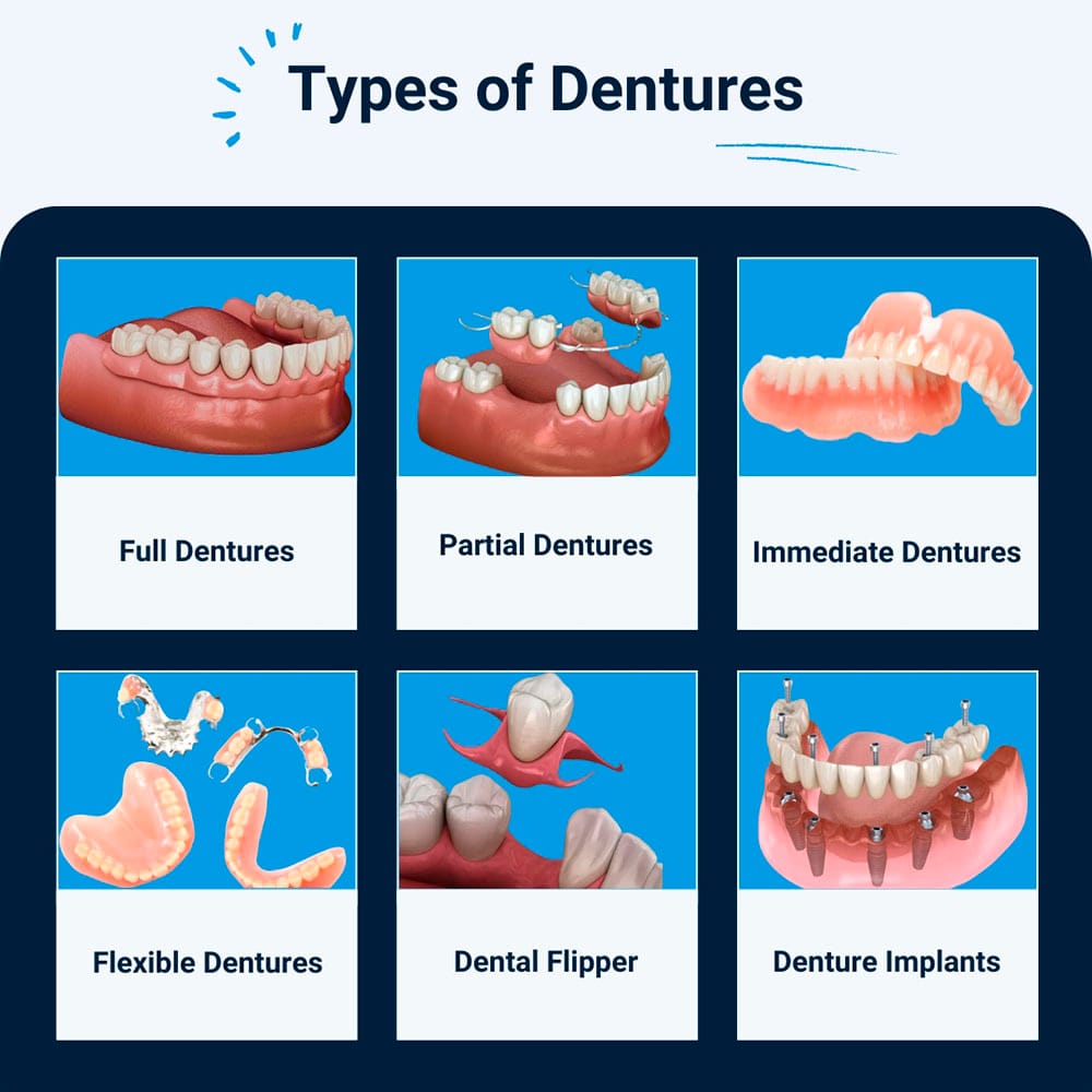 Types of Dentures
