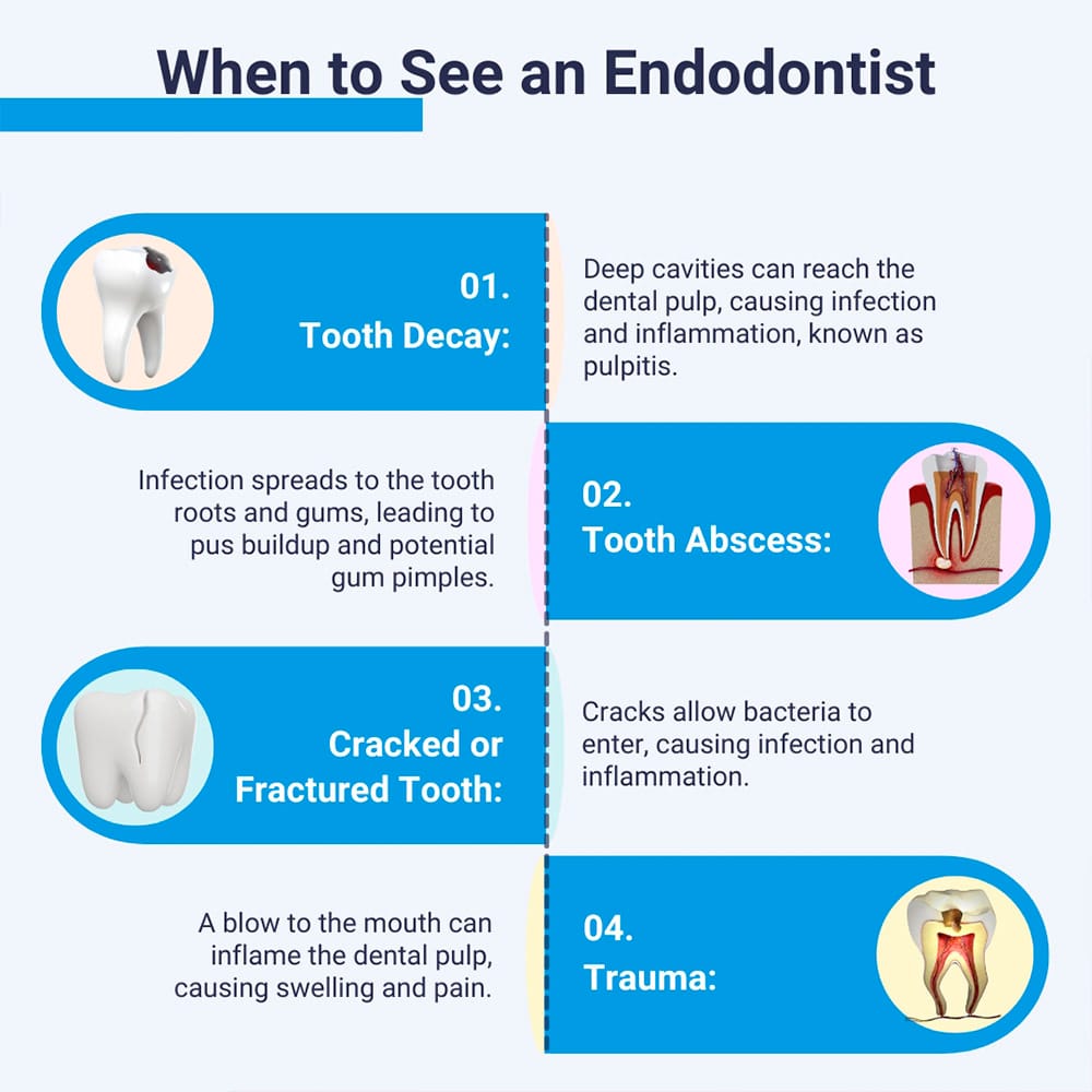 When To See an Endodontist