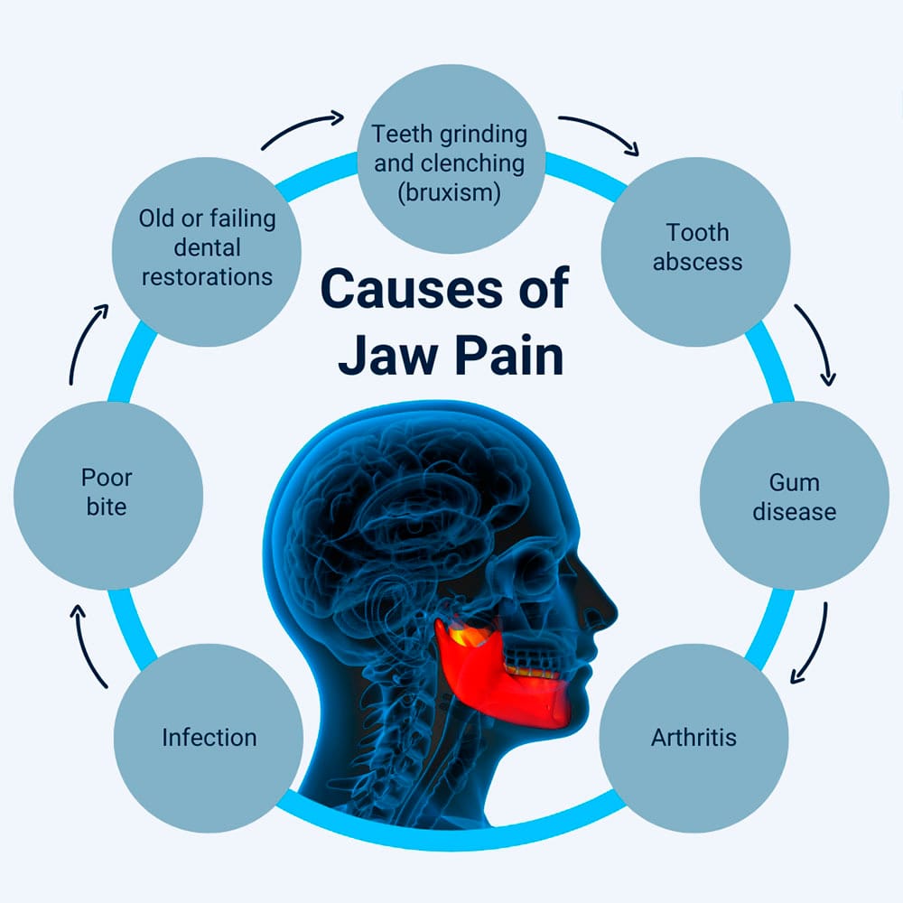Causes of Jaw Pain