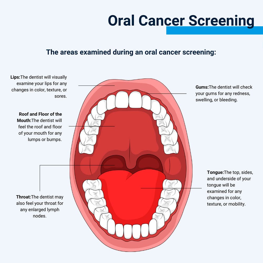 Oral Cancer Screening