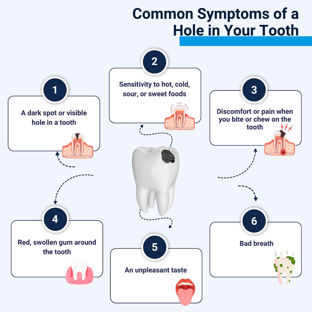 Common Symptoms of Hole in Your Tooth