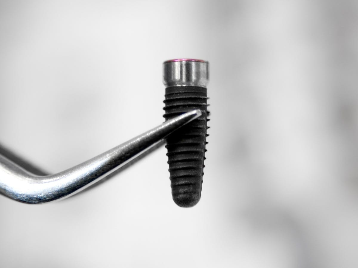 Dental Implant