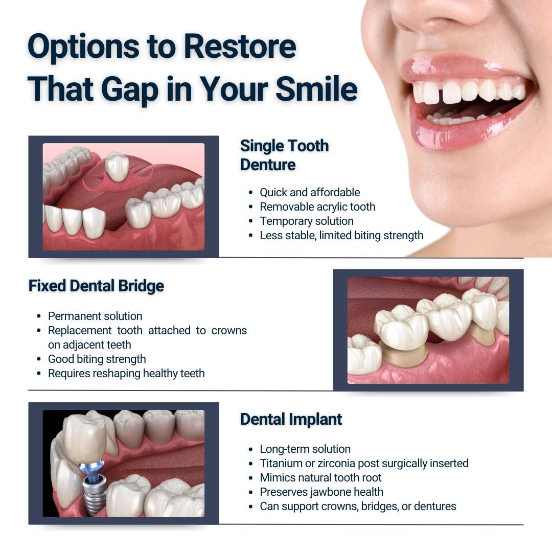 Options To Restore That Gap in Your Smile