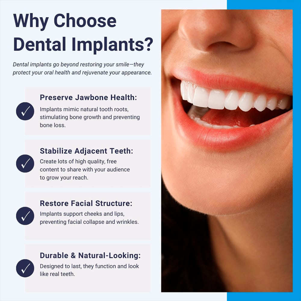 Why Choose Dental Implants