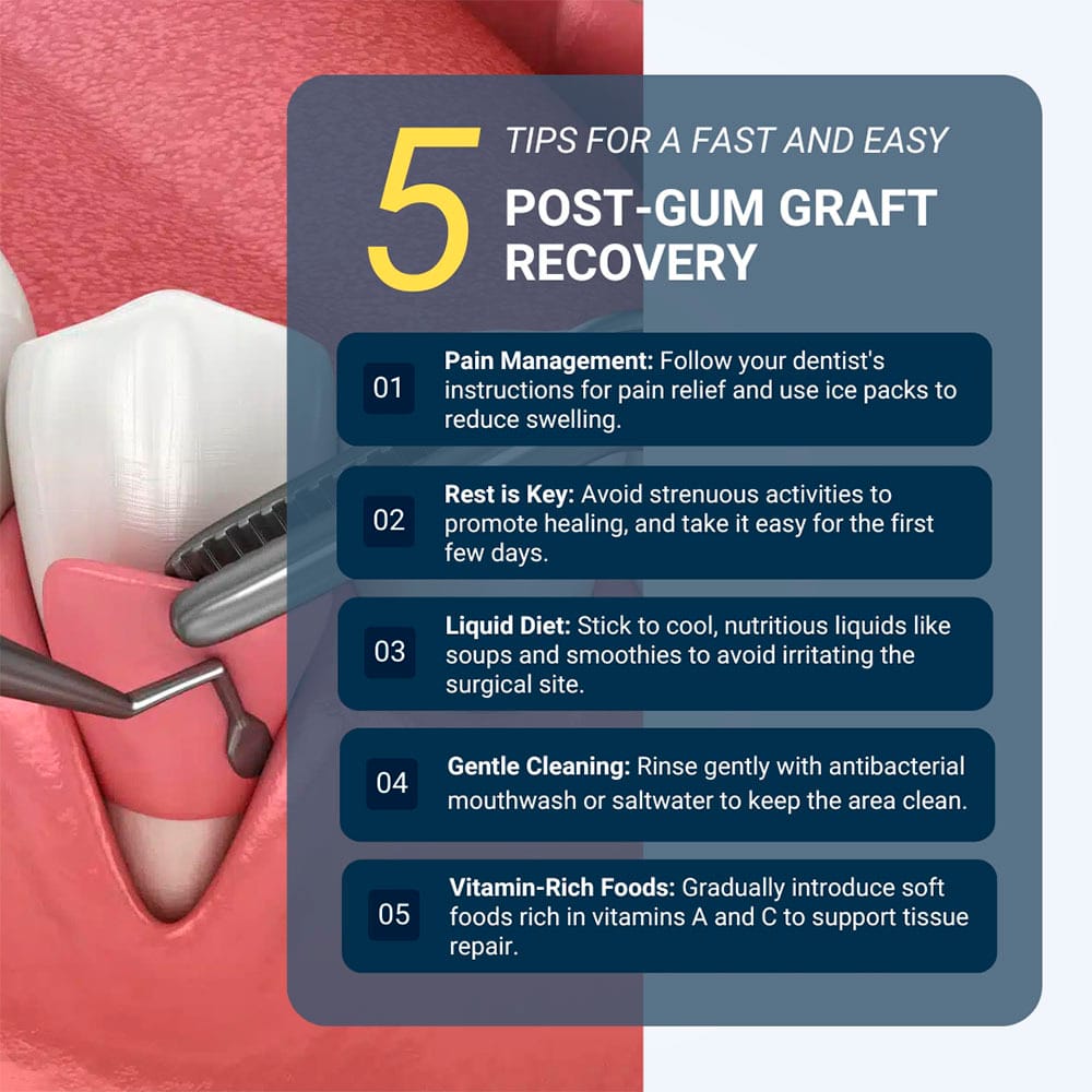 5 Tips for a Fast and easy Post-Gum Graft Recovery