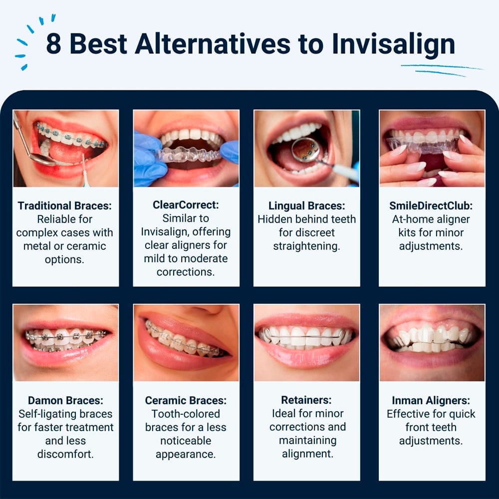 The 8 Best Alternatives to Invisalign