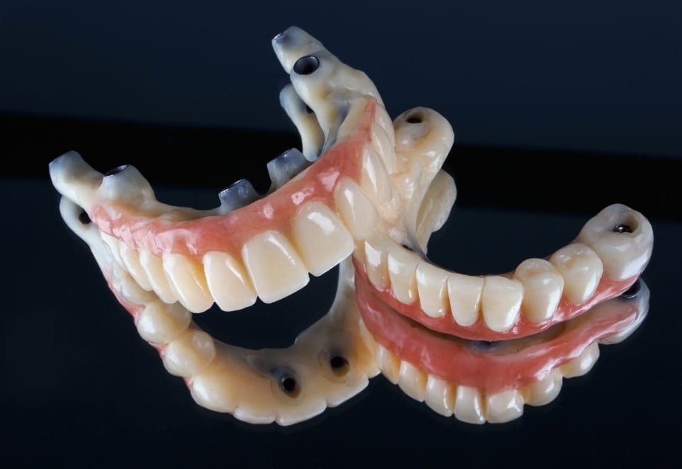 All-on-4 Dental Implants in Franklin Square NY