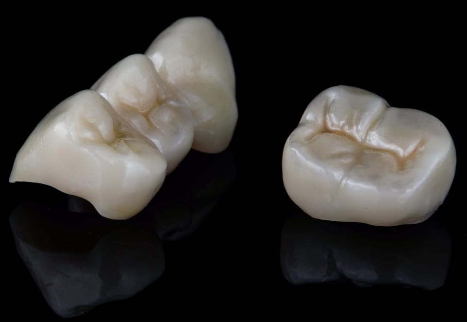 Dental Crown Procedure in Franklin Square NY