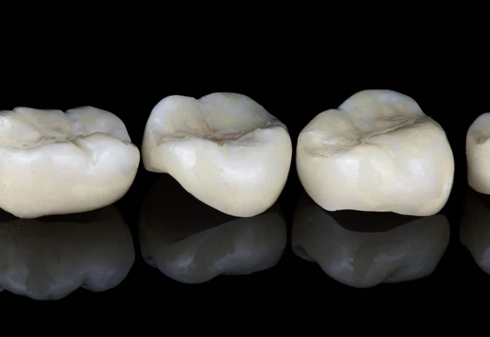 Dental Crowns in Franklin Square NY