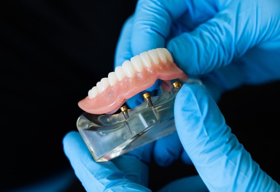 Denture Repair in Franklin Square NY