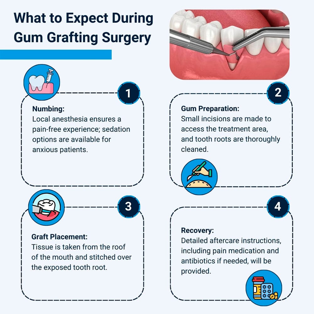 What to Expect During Gum Grafting Surgery