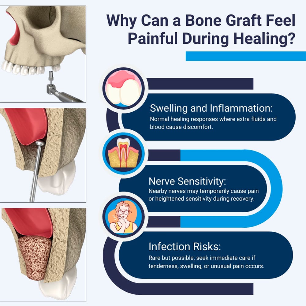 Why Can Bone Graft Feel Painful During Healing