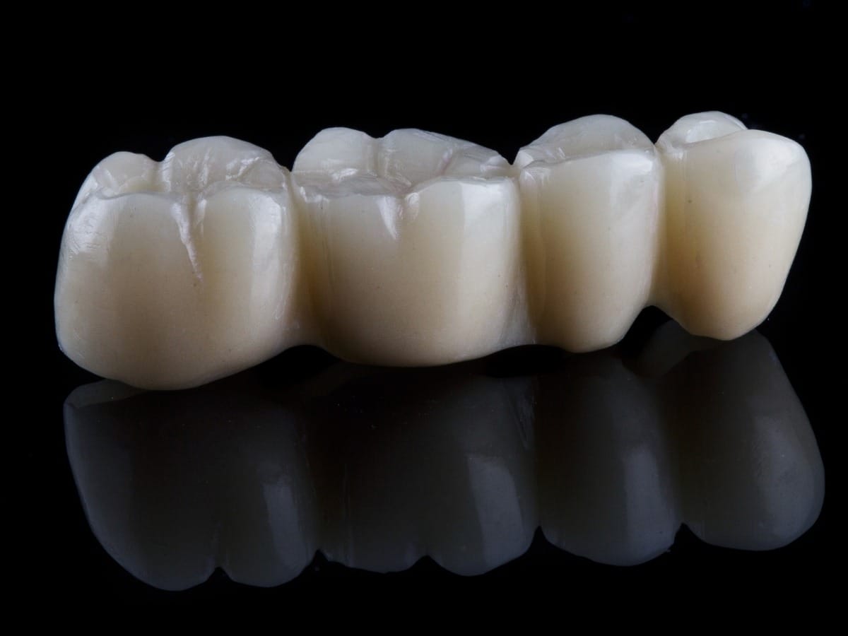 Dental Crowns