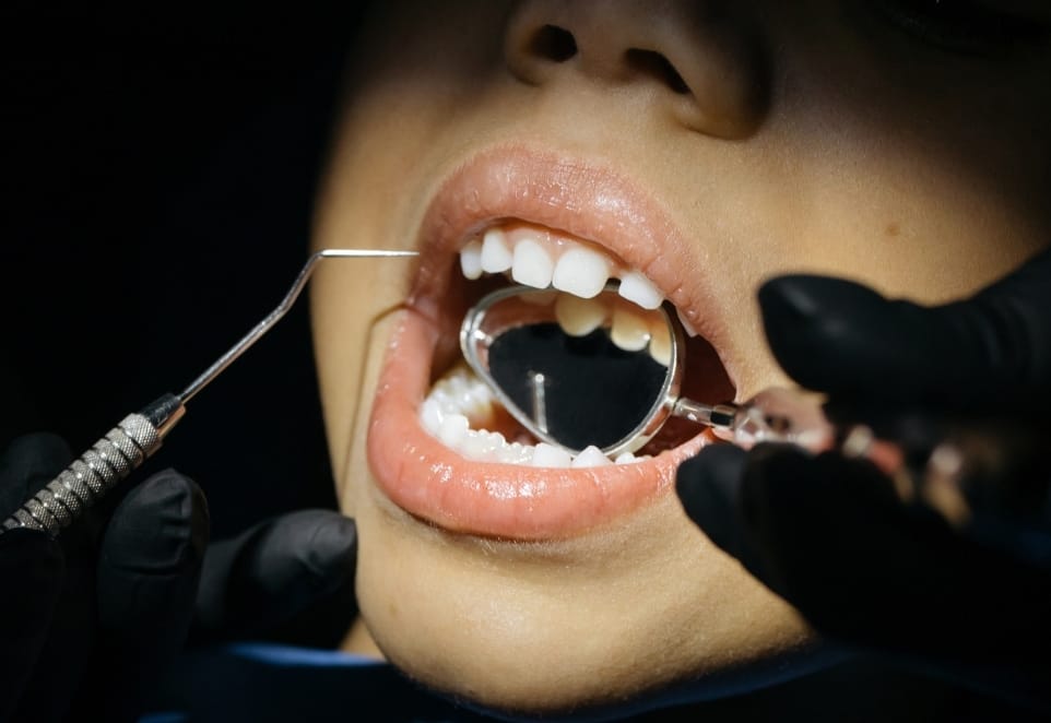 Dental Trauma