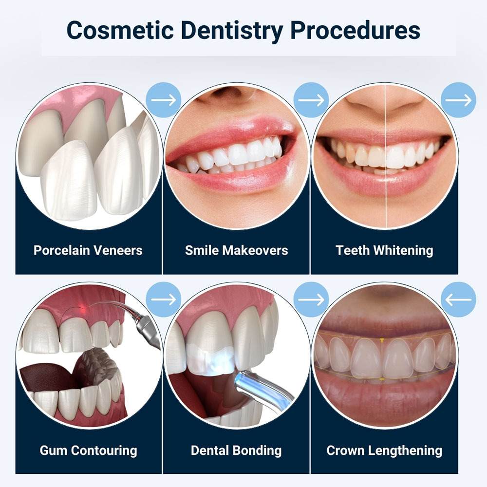 Cosmetic Dentistry Procedures