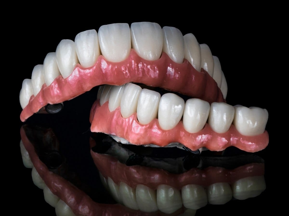 Denture Implants in Franklin Square