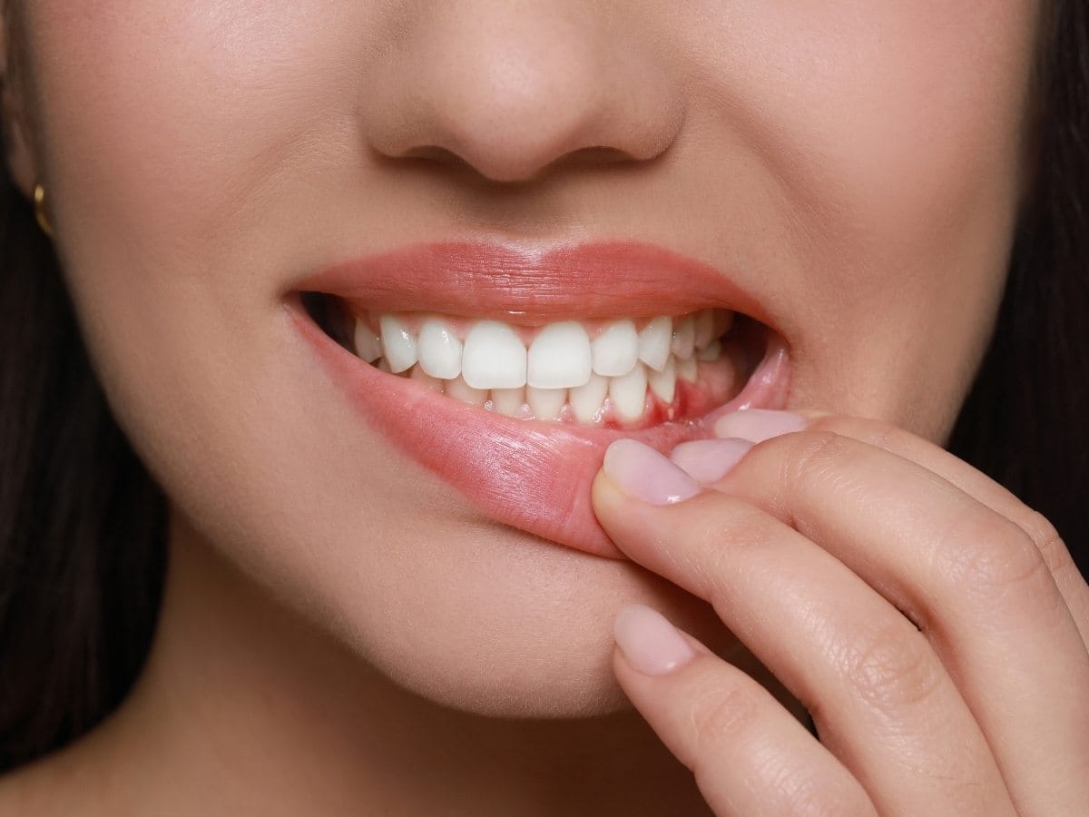 Periodontal Disease in Franklin Square