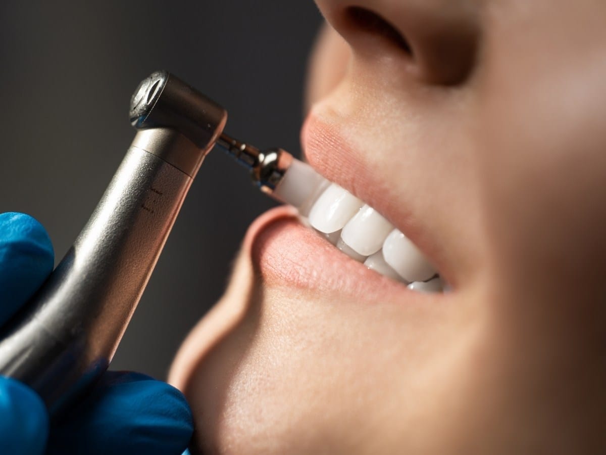 Teeth Cleaning in Franklin Square