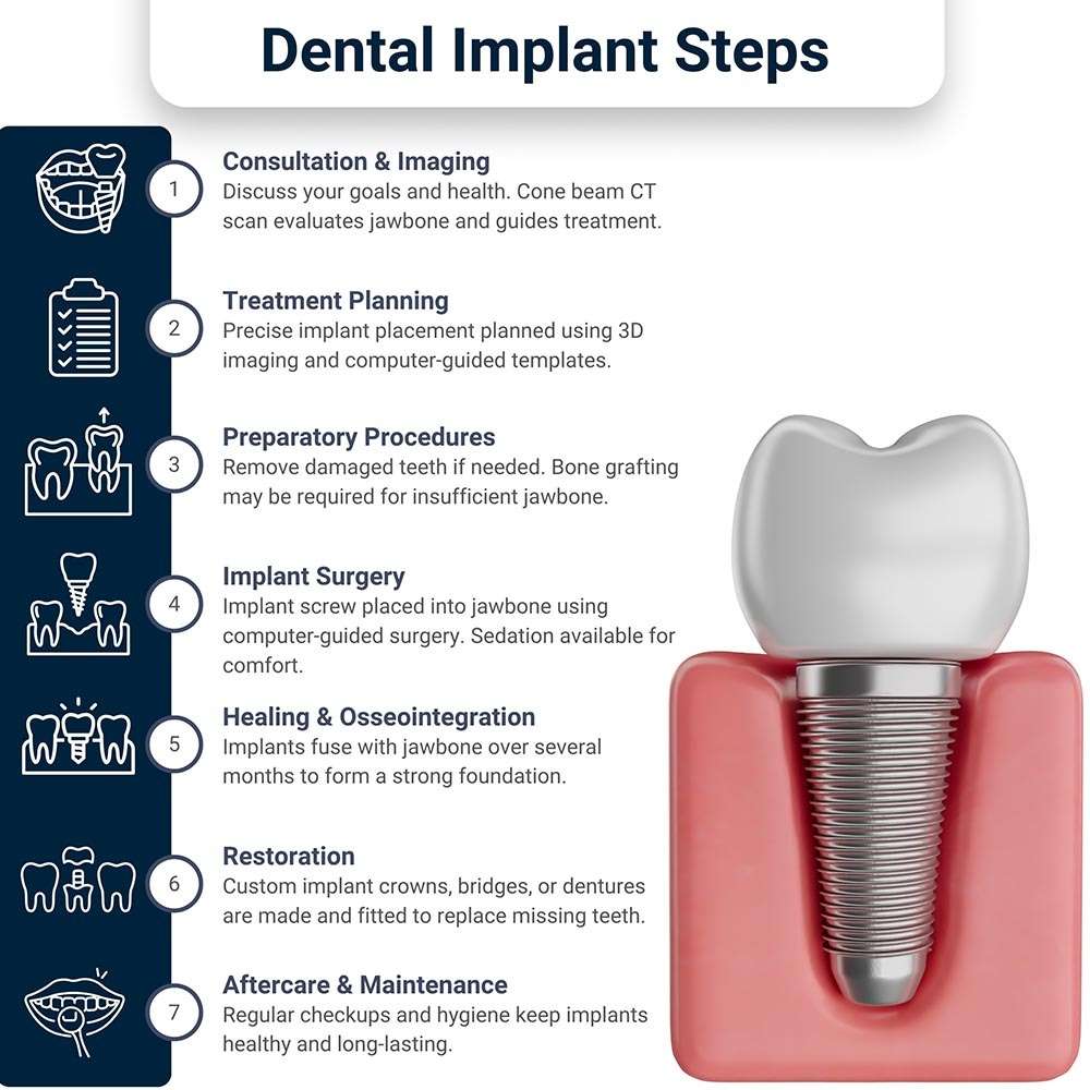 Dental Implant Steps
