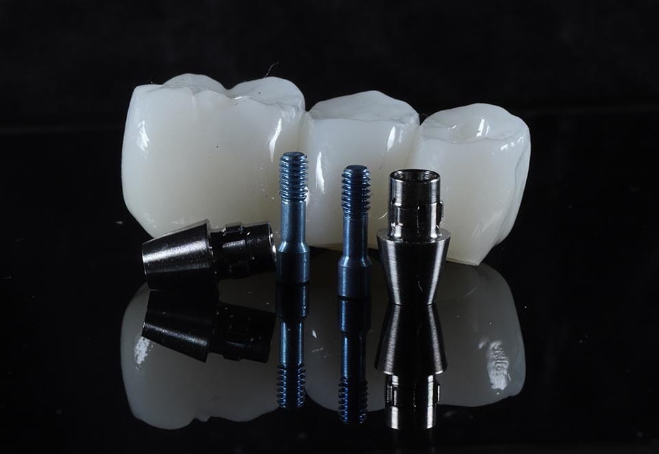 Dental Implant Steps